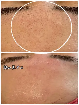 Dione八王子店所属・LUKE （ルーク）のエステ・リラクイメージ