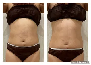 Silky ✖︎ Snow White｜エイジングケア＆美肌脱毛専門サロン所属・O 朋美のエステ・リラクイメージ