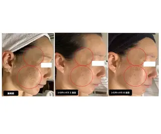 ヴィーナス ビューティーのエステ・リラクイメージ