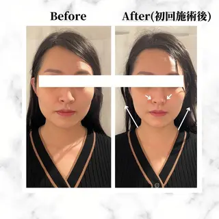 12Dハイフ💗 最強小顔のエステ・リラクイメージ