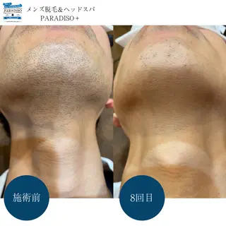 メンズ 【パラディソ＋】後藤 まりやの眉毛・アイブロウイメージ