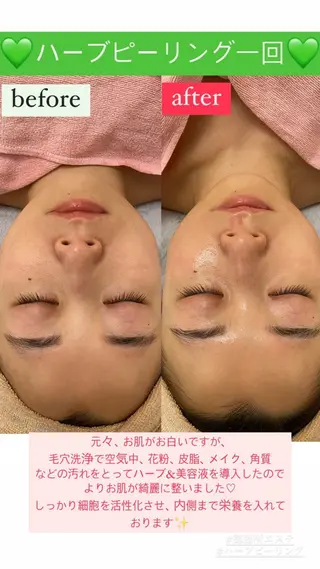 メンズ Salon de Lino 御器所のエステ・リラクイメージ