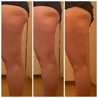 3glitter 肌質改善＆痩身のエステ・リラクイメージ