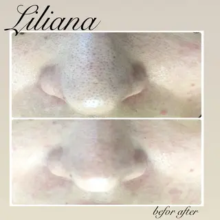 LILIANA所属・LILIANA ☆YURIのエステ・リラクイメージ