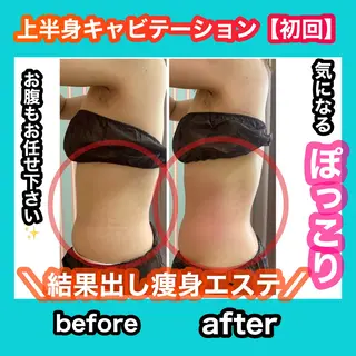 痩身/脱毛/ネイル HARUKAのエステ・リラクイメージ