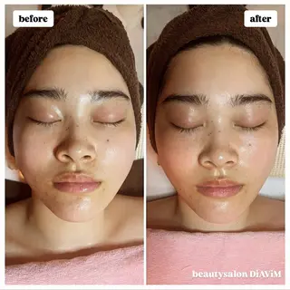 beautysalon  DiAViM所属・本格コルギ美肌美眉 DiAViM 💎のエステ・リラクイメージ