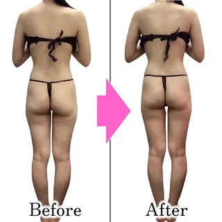 ダイエットラボ梅田店 🌟のエステ・リラクイメージ