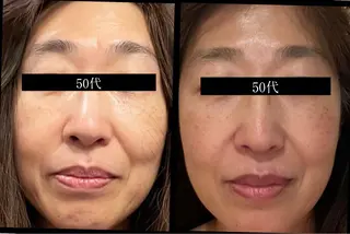 夜エステサロン🌷Luana所属・夜サロン♡ Luana🦋.*˚のエステ・リラクイメージ