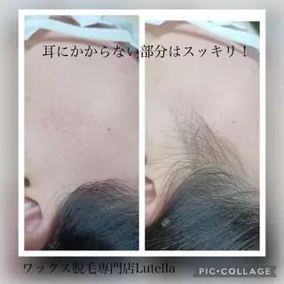 Lutella所属・ワックス脱毛専門店 Lutellaのエステ・リラクイメージ