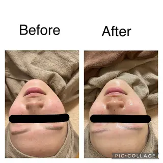 ECXIA ｴｸｼｱのエステ・リラクイメージ