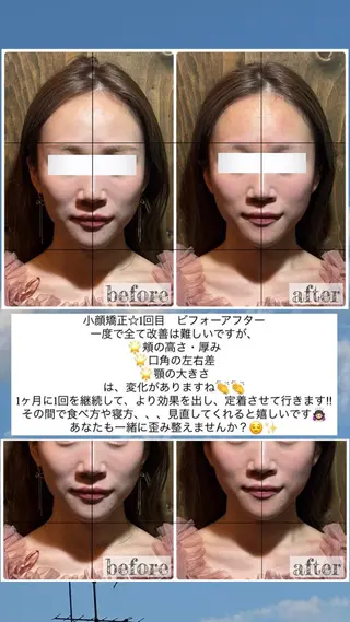 💎後悔させない小顔 矯正💎イトヤマ🌱のエステ・リラクイメージ