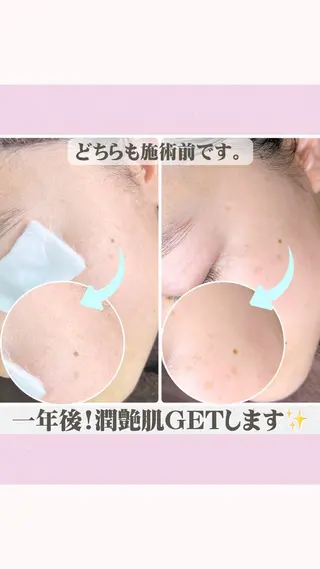 Muqu.所属・Muqu. 毛穴サロンのエステ・リラクイメージ