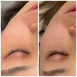 yellow.所属・yellow💛【 脱毛&フェイシャル】のエステ・リラクイメージ