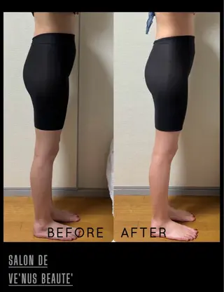 ヴィーナス ビューティーのエステ・リラクイメージ