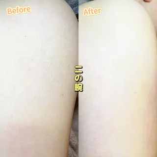 Hit. シュガーリング豊橋のエステ・リラクイメージ