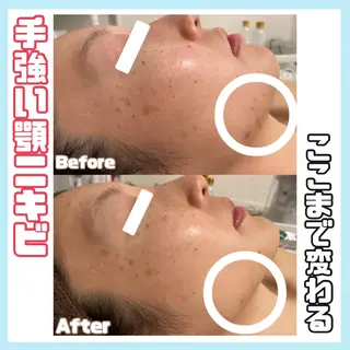 オールハンド専門🤍 kasumiのエステ・リラクイメージ