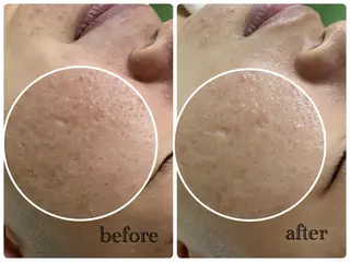 デ・アイム新潟北所属・サイトウ .のエステ・リラクイメージ