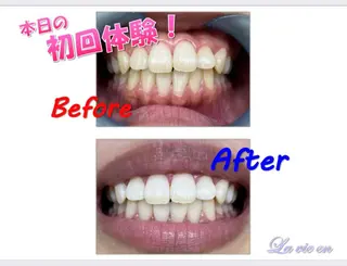 セルフホワイトニングサロン　ラヴィアン所属・ホワイトニングサロン La vie enのその他イメージ