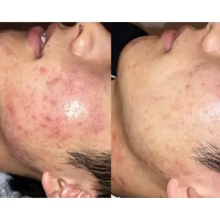 メンズ 【BUB立川】 ゆかのエステ・リラクイメージ