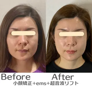 最速小顔・肌質管理 espoirマキのエステ・リラクイメージ