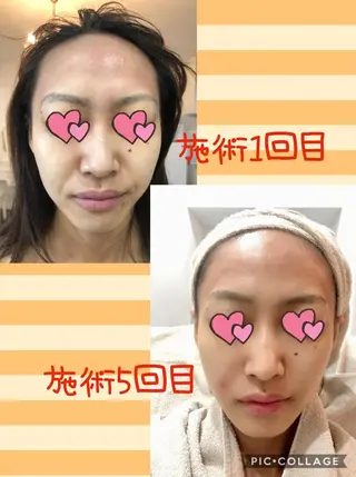 まつ毛パーマ・美肌 ナチュラル　ボーテのマツエク・マツパデザイン