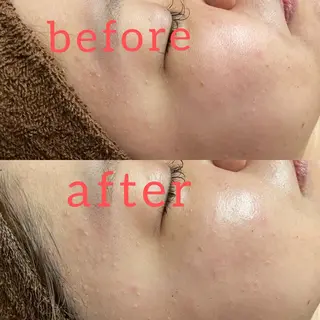 阪神芦屋 natsumiのエステ・リラクイメージ