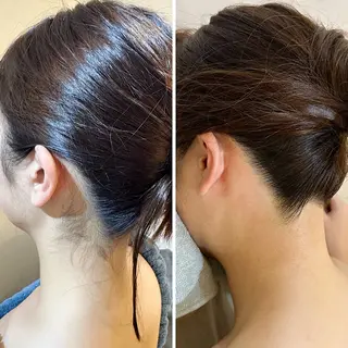 うなじ脱毛/美肌脱毛 LABELのエステ・リラクイメージ