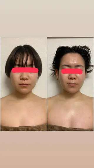 透明感の肌Lino malieのエステ・リラクイメージ