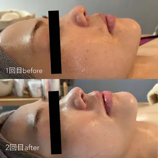 エステティックサロン Liente(リアンテ)所属・Hashimoto .のエステ・リラクイメージ