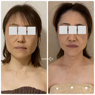 private salon.ohana所属・小顔/ララピール ohanaのエステ・リラクイメージ