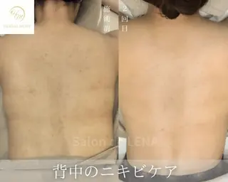 Grandir所属・ハーブピーリング専門 グランディール　武内のエステ・リラクイメージ