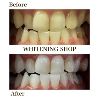 ホワイトニングショップ静岡葵区店所属・ホワイトニング ショップ葵区静岡駅店のその他イメージ