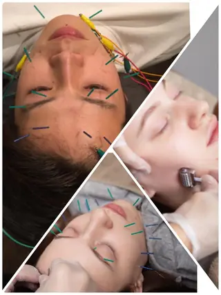 表参道鍼灸院K 美容鍼🔮ララピールのエステ・リラクイメージ