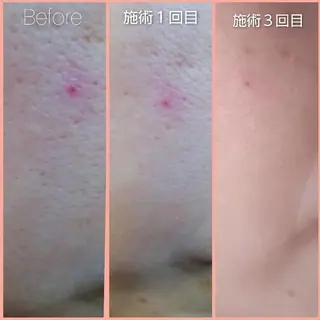 エステサロン　Lazulisea所属・川口 春奈のエステ・リラクイメージ