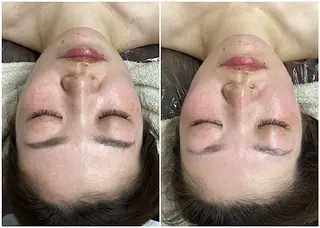 ize 横浜店のエステ・リラクイメージ