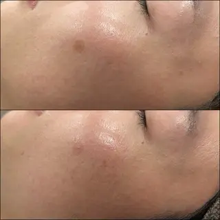 LiZA エステティックサロンのエステ・リラクイメージ