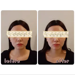 女性専門 Luna time 整体院所属・Luna time  整体院　金子ゆかのエステ・リラクイメージ