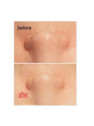 毛穴小顔・痩身サロン メイク・ド・ミュウのその他イメージ