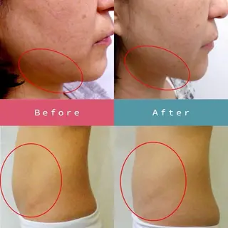 Cheerful所属・痩身＆身体改善専門 Cheerfulのエステ・リラクイメージ