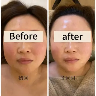 本格小顔コルギサロン ミピマムマールのエステ・リラクイメージ