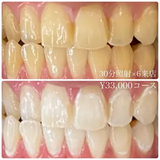 PLATINUM Beauty 横浜店所属・ホワイトニングルーム 横浜店のその他イメージ