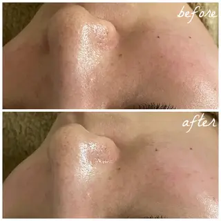 メンズ メナード岐阜市茜部 杉浦のエステ・リラクイメージ