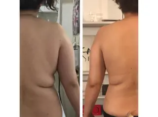 YOSAPARK Lino.大分駅前店のエステ・リラクイメージ