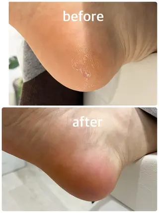 足・爪トラブル専門店　foot grace所属・加藤 望のネイルデザイン