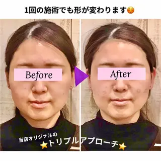 小顔矯正Speed KOGAO渋谷本店のエステ・リラクイメージ