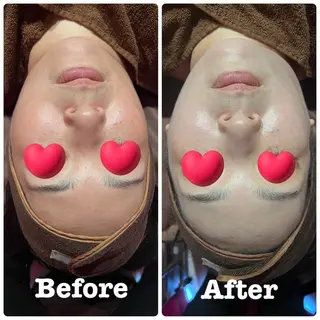 SHAPY HIGH SLIMMING ESTHETIC所属・嚴 キララのエステ・リラクイメージ