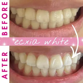 セルフホワイトニングサロン　エクシアホワイト西尾店所属・エクシアホワイト西尾 堀内恵のその他イメージ