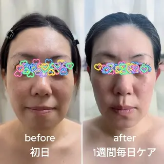 潤 うるむのエステ・リラクイメージ