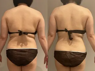 Esthetic MiEUXのエステ・リラクイメージ