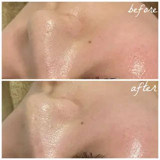 メンズ メナード岐阜茜部 杉浦のエステ・リラクイメージ